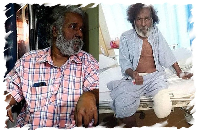 Sathiya selesai jalani potong kaki kiri lagi